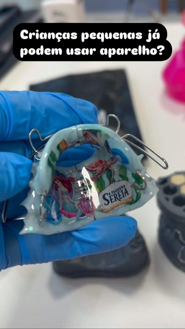 Sim! A ciência evoluiu muito, e hoje o ideal é que no momento oportuno, isto é, quando detectamos qualquer alteração no desenvolvimento da oclusão da criança, fazemos esta avaliação para buscar uma solução imediata que vai livrar esta criança de tratamentos mais complicados no futuro. O fluxo digital facilitou muito este diagnóstico, e o que precisamos hoje é conscientizar os pais da importância do acompanhamento desde a tenra idade, para que possamos identificar logo qualquer alteração. E você? Tem esta consciência de levar seu filho com regularidade ao Odontopediatra?